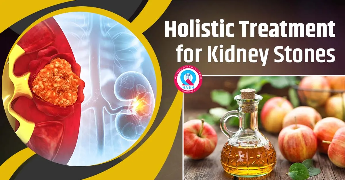 Holistic Treatment for Kidney Stones: Heal Naturally, Stay Happy!